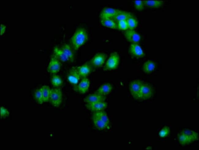100UG DLK1 ANTIBODY 100 ug