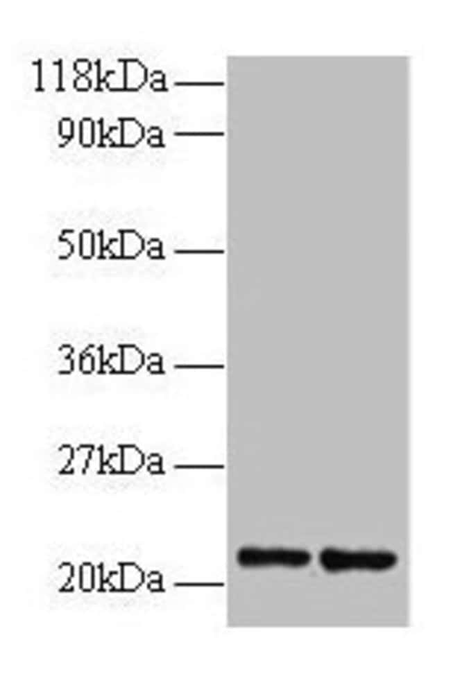 100UG RPS9 ANTIBODY 100 ug