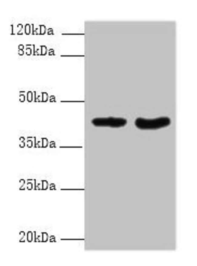 100UG DMKN ANTIBODY 100 ug