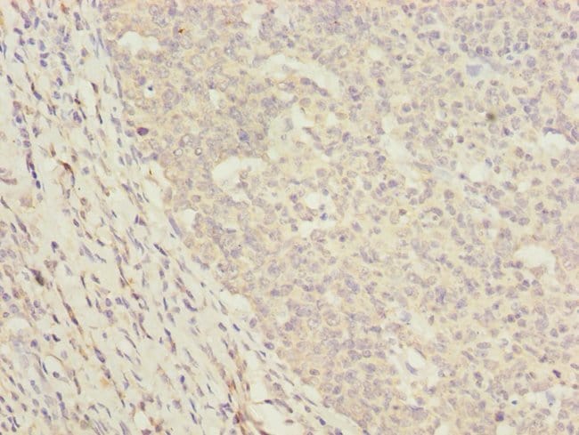100UL DNAJA2 ANTIBODY 100 ul