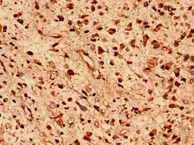 100UG DNAJB5 ANTIBODY 100 ug