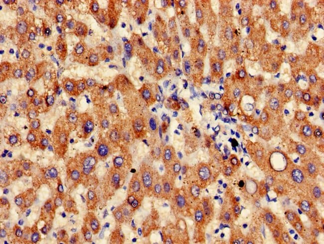 100UG B4GALT3 ANTIBODY 100 ug