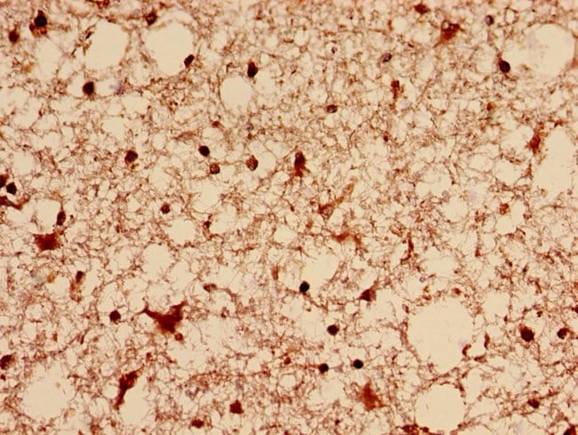 100UG DNM1L ANTIBODY 100 ug