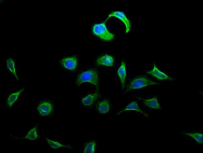 100UG DOK5 ANTIBODY 100 ug