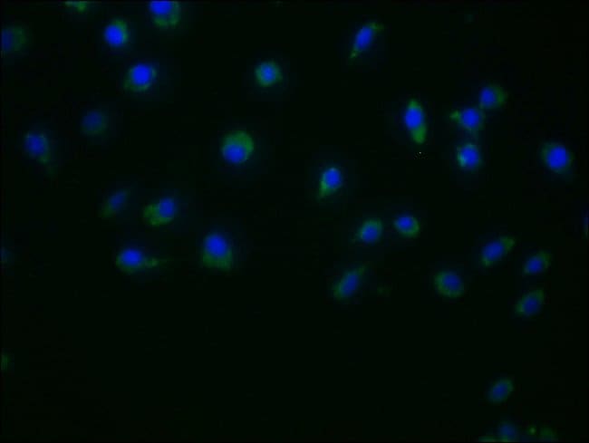100UL DUOX2 ANTIBODY 100 ul