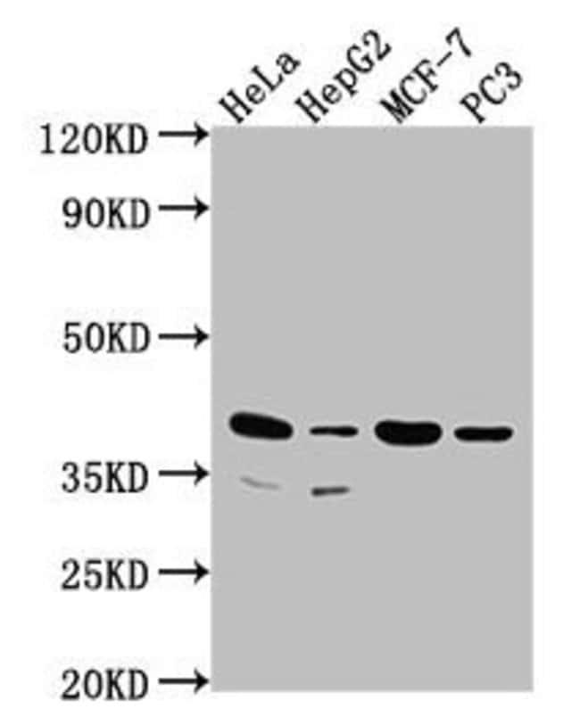 100UL DUSP11 ANTIBODY 100 ul