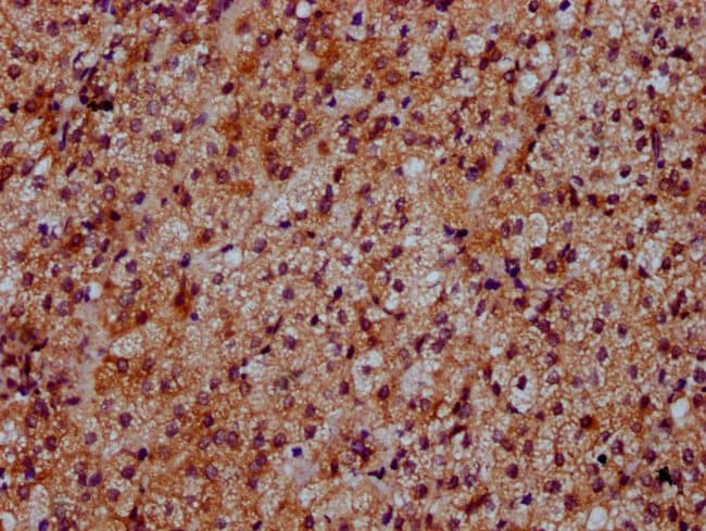 100UG DYM ANTIBODY 100 ug