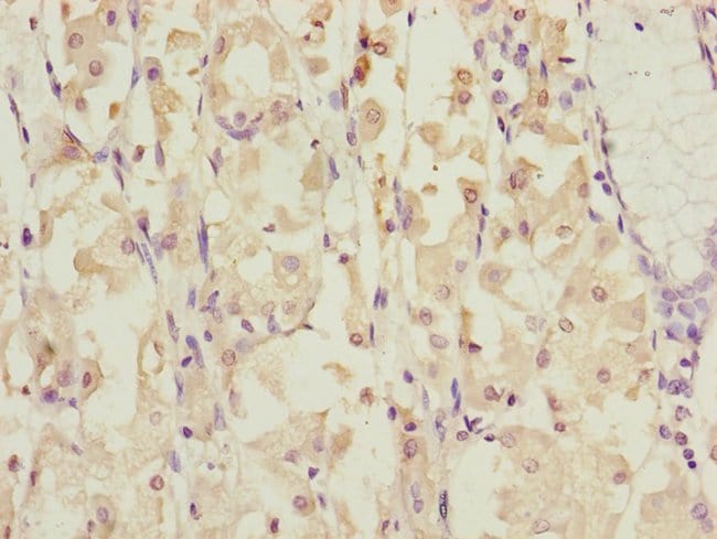 100UL DYNC1I1 ANTIBODY 100 ul