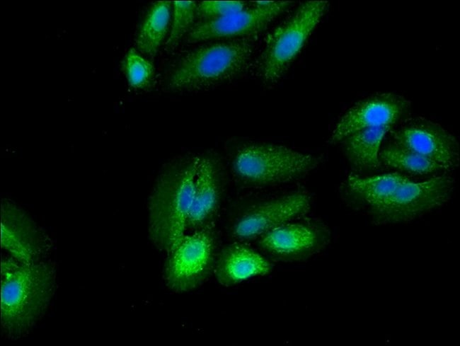 100UG RPS5 ANTIBODY 100 ug