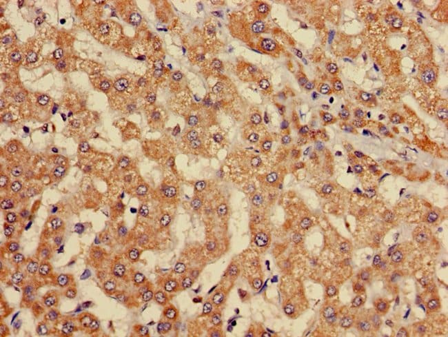 100UG EBI3 ANTIBODY 100 ug