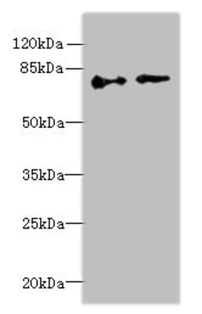 100UG ECD ANTIBODY 100 ug