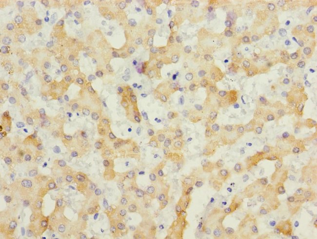 100UL ECHS1 ANTIBODY 100 ul