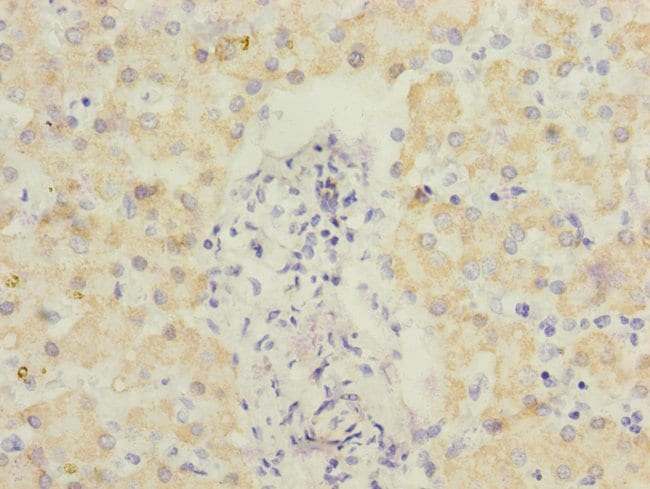 100UL ECHS1 ANTIBODY 100 ul