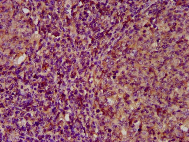 100UG ECM1 ANTIBODY 100 ug