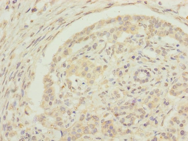 100UL EDIL3 ANTIBODY 100 ul
