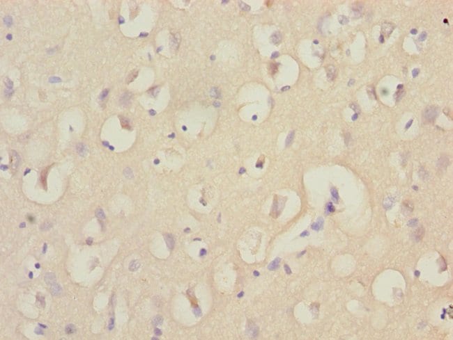 100UL EEF1A2 ANTIBODY 100 ul