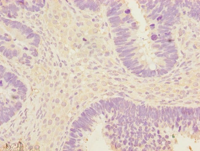 100UL EEF1A2 ANTIBODY 100 ul