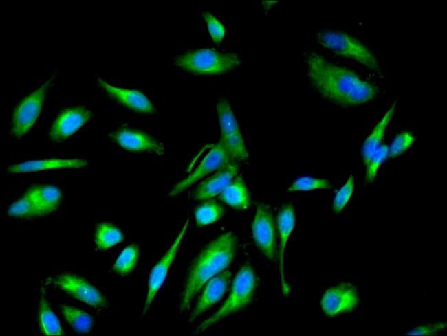100UG EEF1E1 ANTIBODY 100 ug