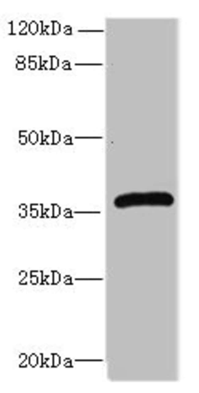 100UG EPHRIN B3 ANTIBODY 100 ug