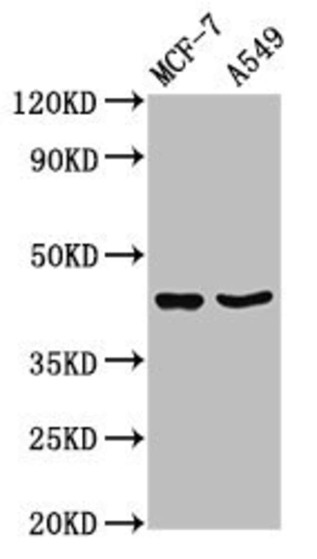 100UG EGR3 ANTIBODY 100 ug