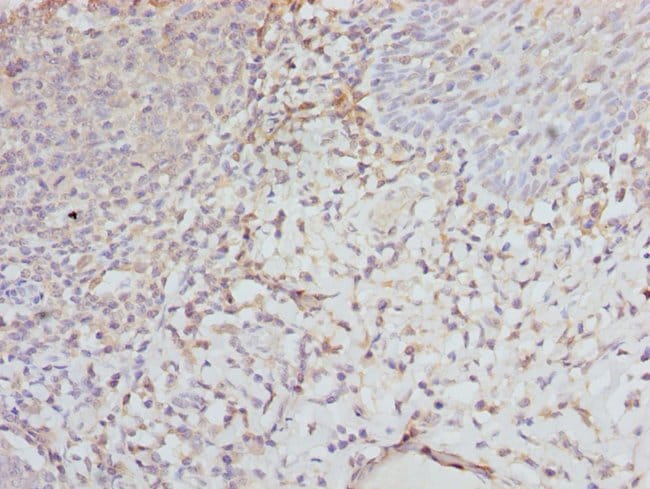 100UL EIF2 GAMMA ANTIBODY 100 ul