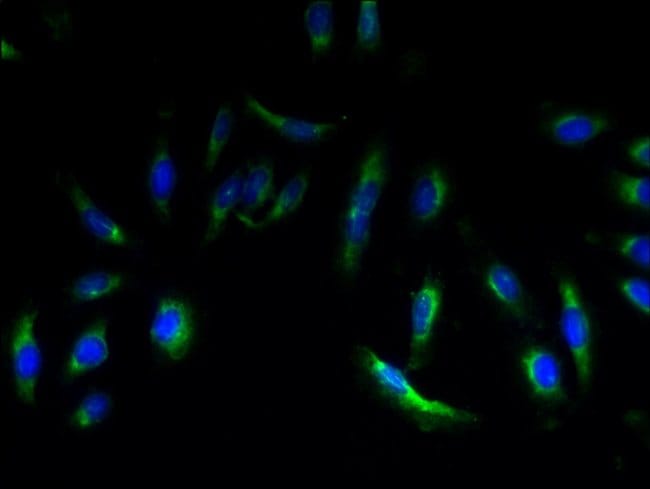 100UG EMP3 ANTIBODY 100 ug