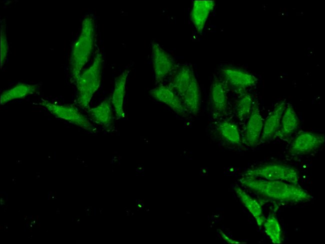 100UG EN2 ANTIBODY 100 ug