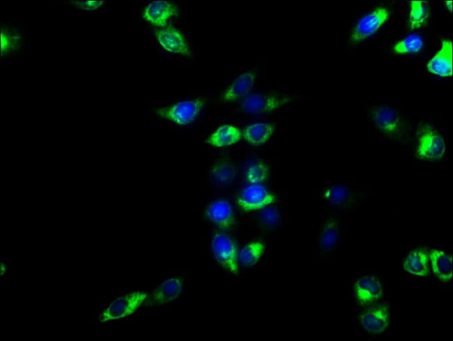 100UG CD39 ANTIBODY 100 ug