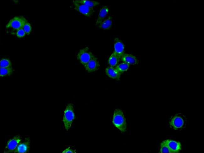 100UG ENTPD8 ANTIBODY 100 ug