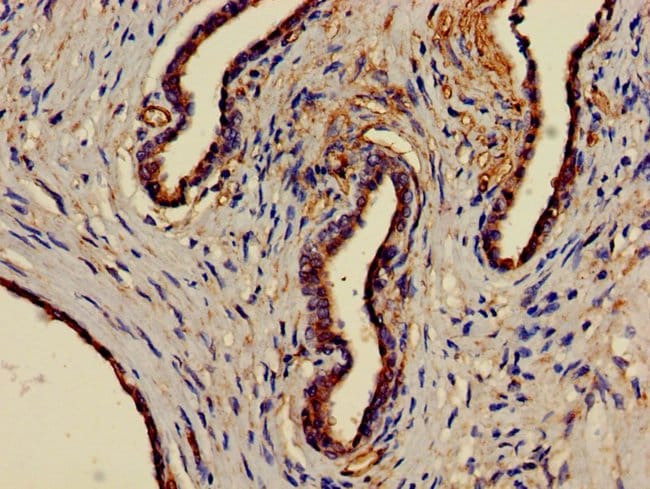 100UG EPHX1 ANTIBODY 100 ug