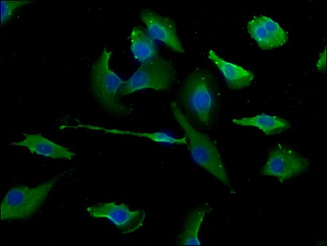 100UL ERC1 ANTIBODY 100 ul