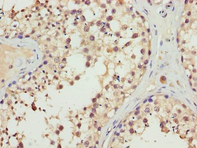 100UL ERLIN2 ANTIBODY 100 ul