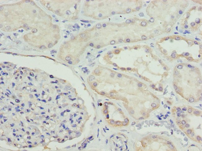 100UL ETFA ANTIBODY 100 ul