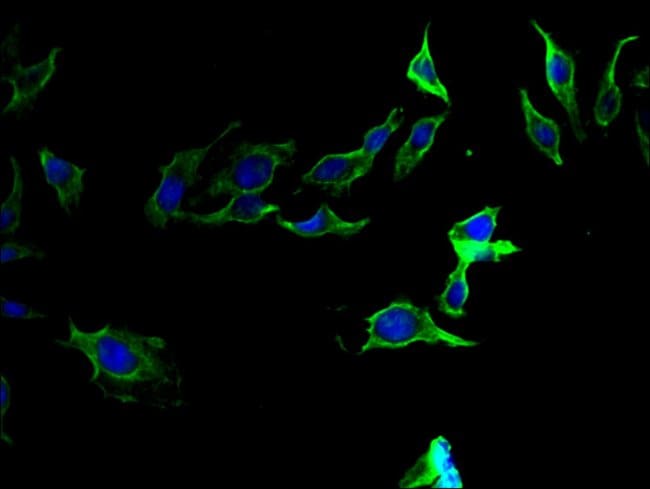 100UG PROTHROMBIN ANTIBODY 100 ug