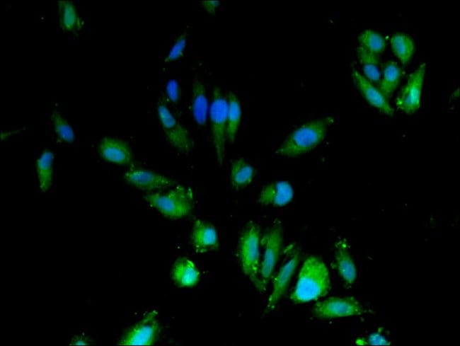 100UG CDA ANTIBODY 100 ug