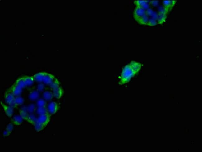 100UL FDFT1 ANTIBODY 100 ul