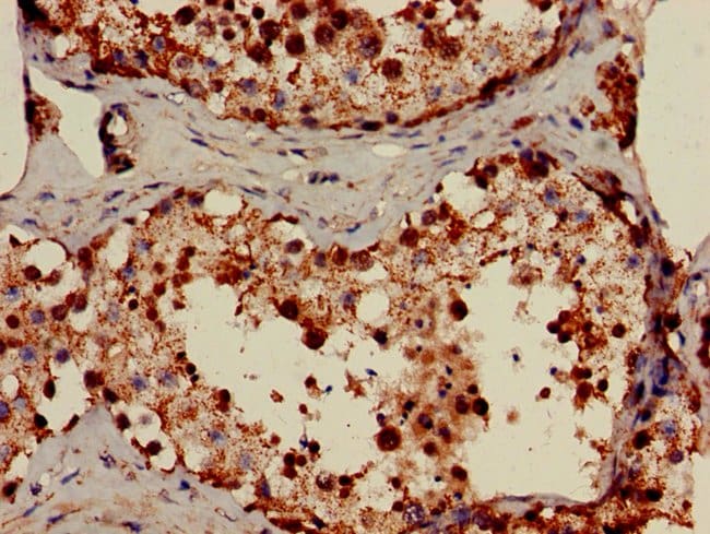 100UG FDXR ANTIBODY 100 ug