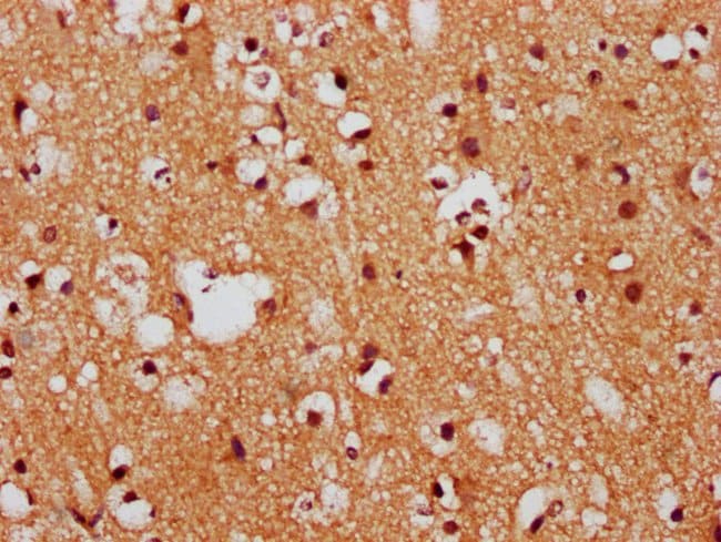 100UG FEZF1 ANTIBODY 100 ug