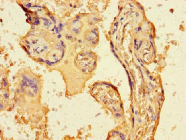 100UG FGF13 ANTIBODY 100 ug