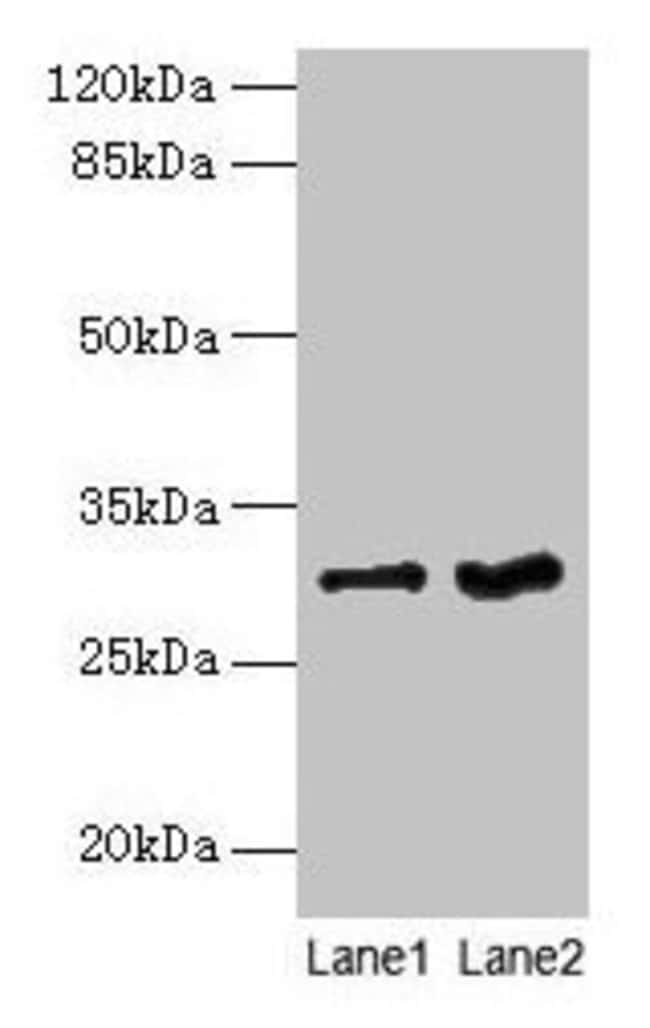 100UG FGFR1OP2 ANTIBODY 100 ug