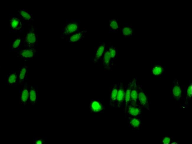 100UG FIBP ANTIBODY 100 ug