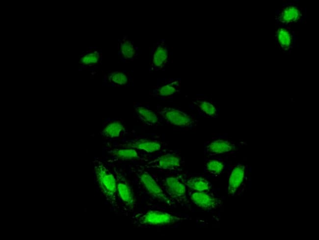 100UG FKBP25 ANTIBODY 100 ug