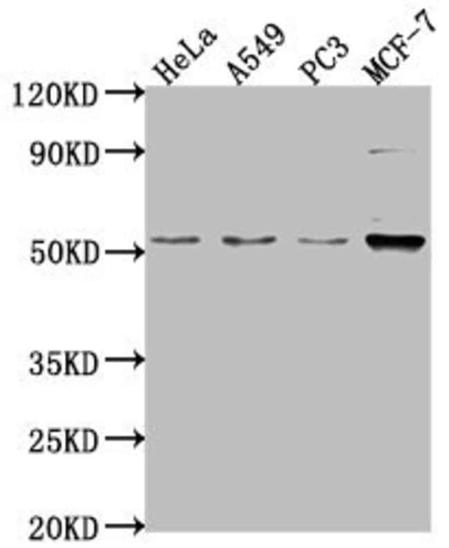 100UL FKTN ANTIBODY 100 ul
