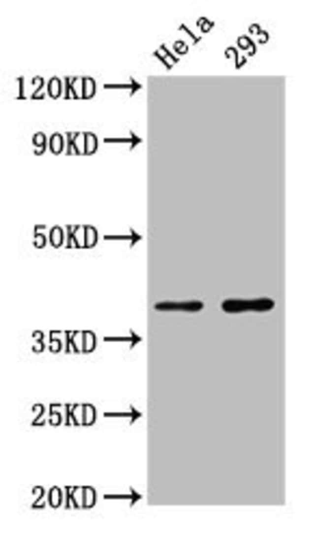 100UG FOXH1 ANTIBODY 100 ug