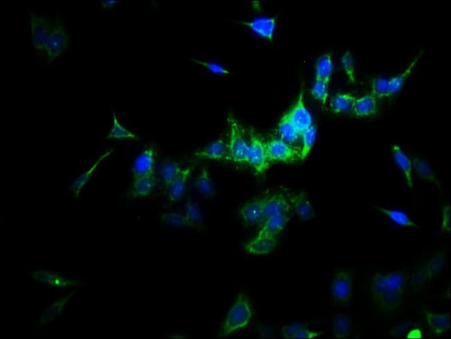 100UG SULT1A3 ANTIBODY 100 ug