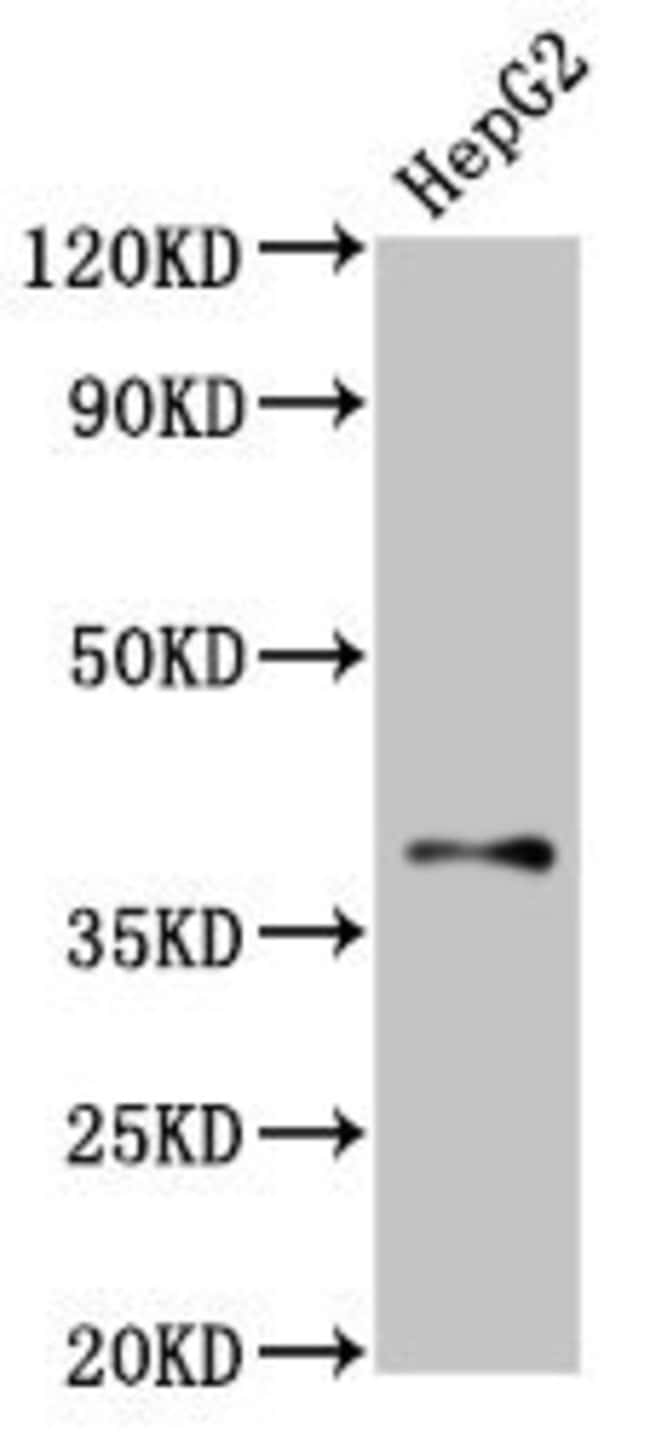 100UG GALR1 ANTIBODY 100 ug