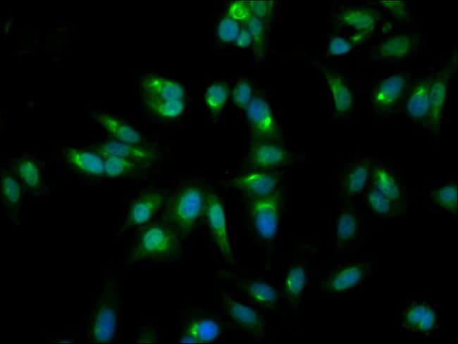100UG GALT ANTIBODY 100 ug