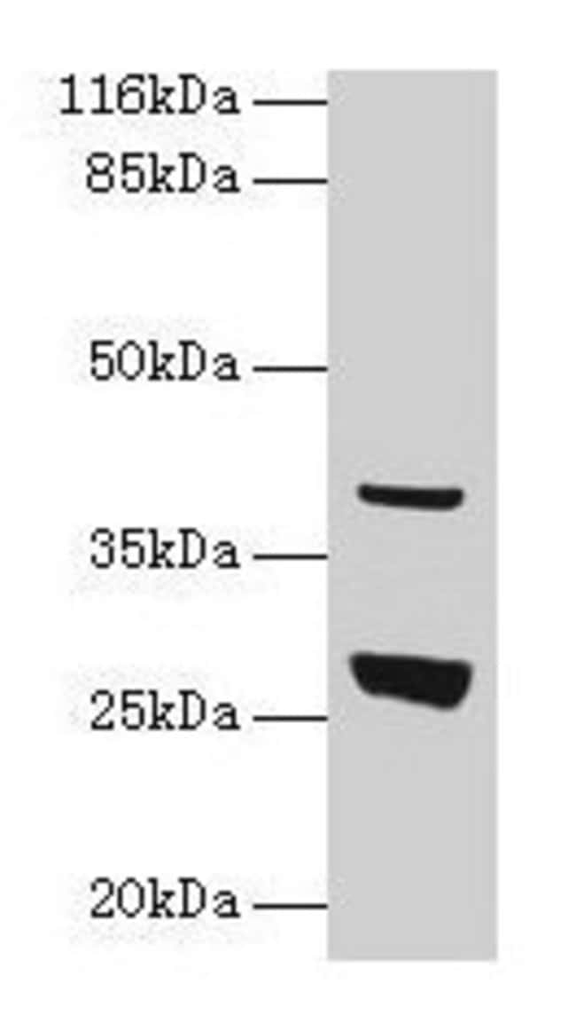 100UG GAMT ANTIBODY 100 ug