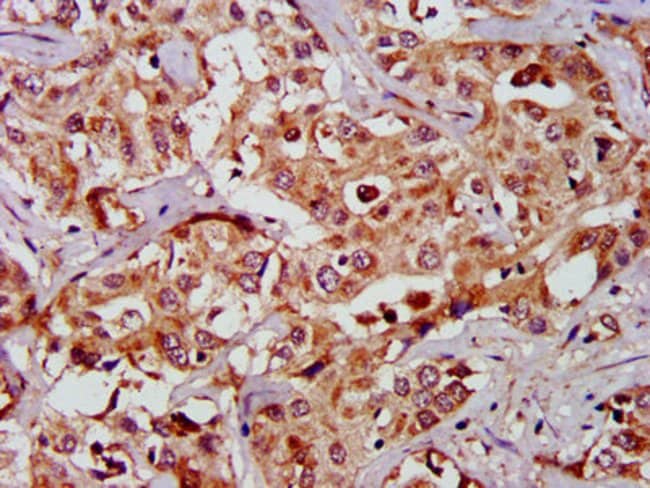 100UG GAS2 ANTIBODY 100 ug