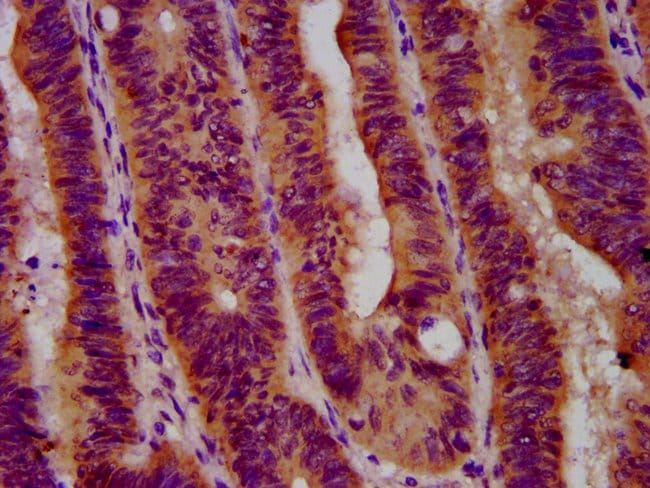 100UG GBA ANTIBODY 100 ug